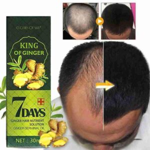 Hair Growth Serum, Hair Care Product, Hair Serum, Fast Hair Growth, Hair Growth & Hair Thickening,Stop Hair Loss, Grow Hair Fast, Hair Loss Treatment for Men & Women(30ml)