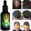 Hair Growth Serum, Hair Care Product, Hair Serum, Fast Hair Growth, Hair Growth & Hair Thickening,Stop Hair Loss, Grow Hair Fast, Hair Loss Treatment for Men & Women(30ml)